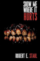 Show Me Where It Hurts | Robert E. Stahl